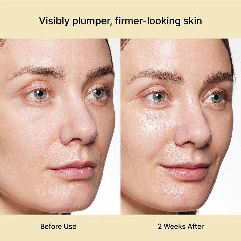 Rejuran Dual Effect Ampoule
