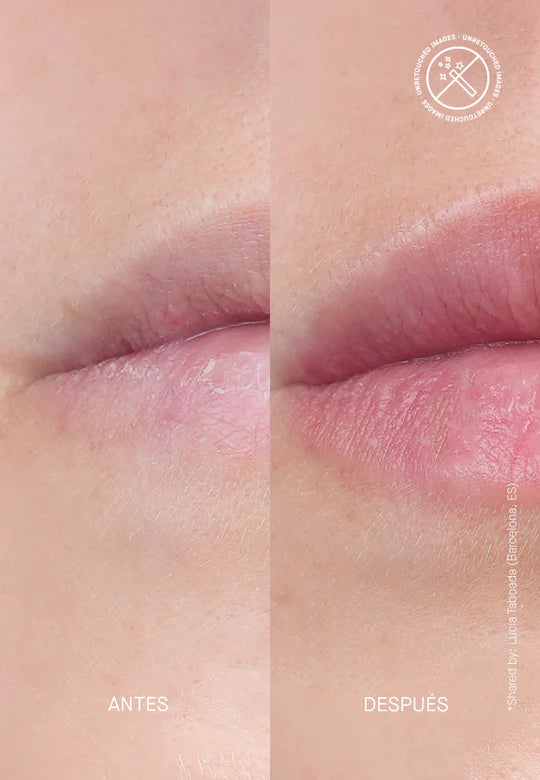 Transparent Lab Volume Hydrating Lip Plumping Treatment