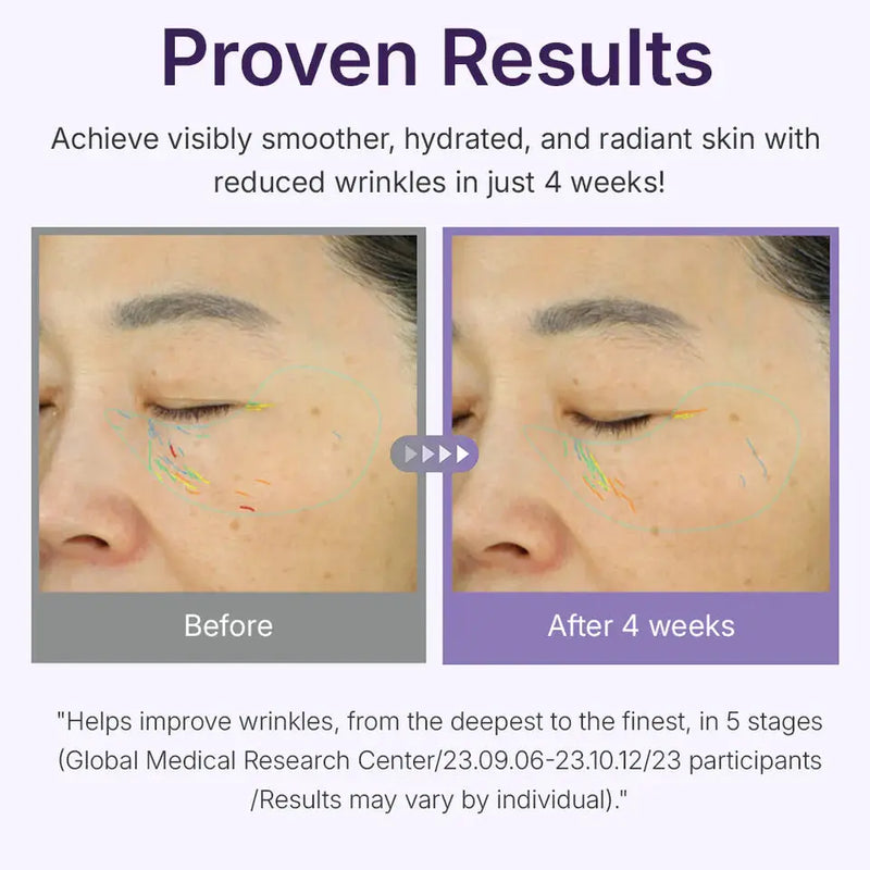 Centellian24 360º Shot PDRN Active Serum