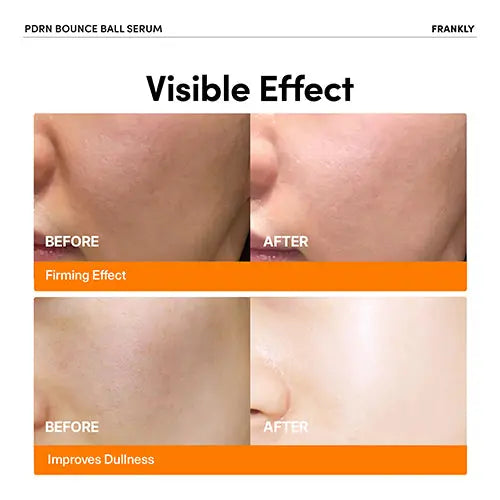 FRANKLY PDRN Bounce Ball Serum