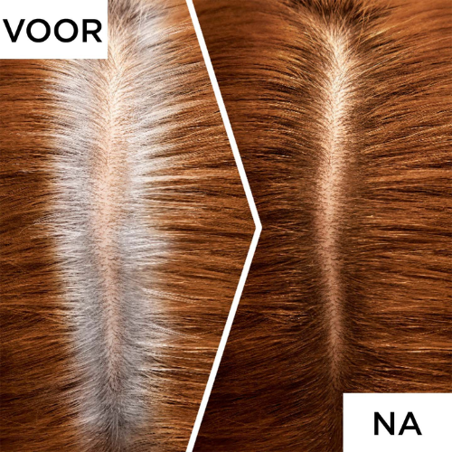 L'Oréal Paris Magic Retouch Goud Midden bruin